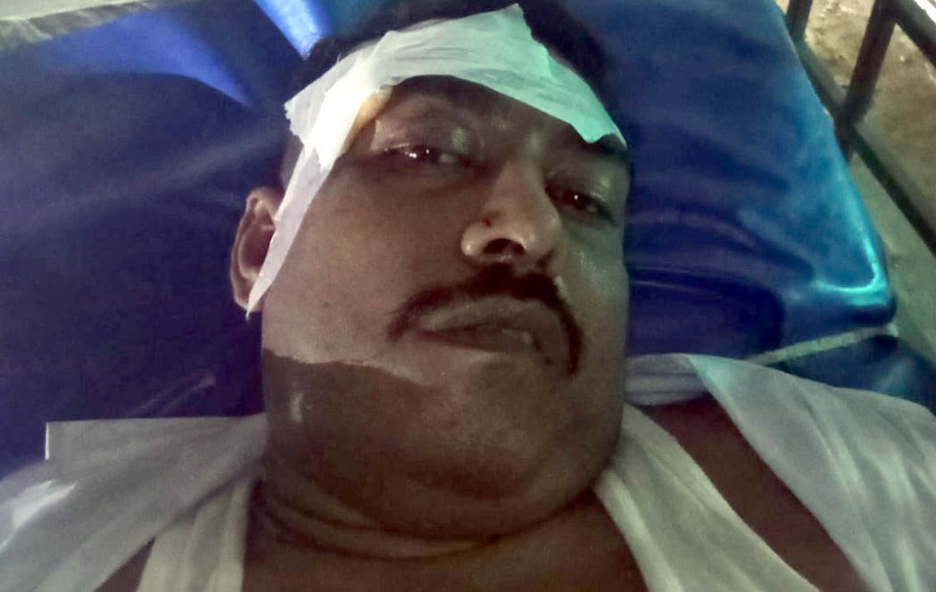 হাজিরা দিয়ে ফেরার পথে আদালত চত্বরে হামলা, আহত আব্দুল করিম