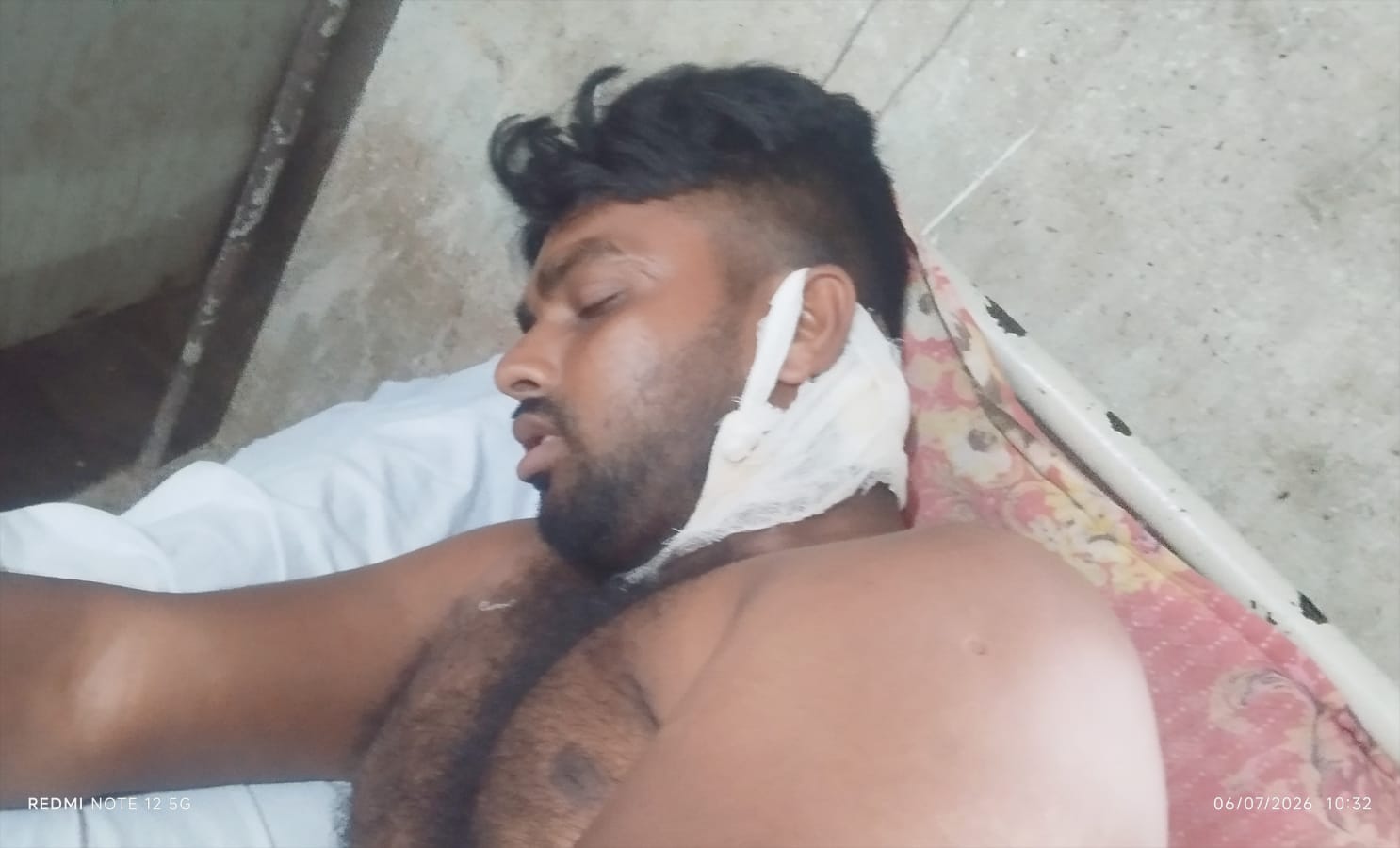 দেবহাটায় তুচ্ছ ঘটনাকে কেন্দ্র করে প্রতিপক্ষের দায়ের কোপে যুবক আহত।